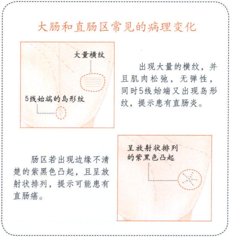 手掌上的大腸和直腸區(qū)